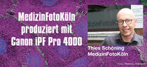 MedizinFotoKöln produziert mit dem iPF Pro 4000 von Canon Bilder in höchster Qualität.